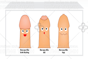 Bao quy đầu là gì, khi nào cần cắt bao quy đầu?