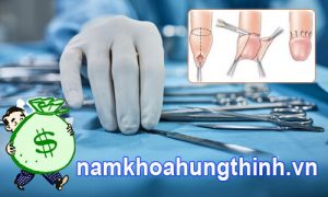 chi phí cắt bao quy đầu đắt hay rẻ