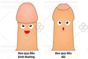 Dài và hẹp bao quy đầu có gây vô sinh không?