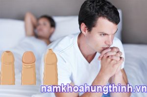 Hẹp bao quy đầu có quan hệ được không