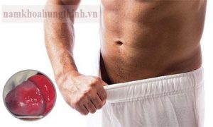 Khám viêm bao quy đầu ở đâu