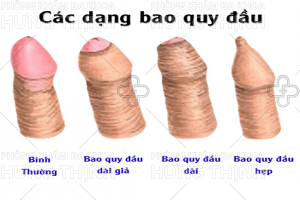 Những bệnh nam khoa thường gặp hiện nay