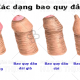 Những bệnh nam khoa thường gặp hiện nay