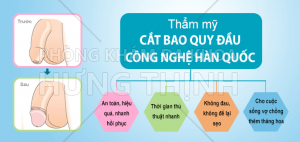 Phương pháp và quy trình cắt bao quy đầu an toàn, nhanh chóng