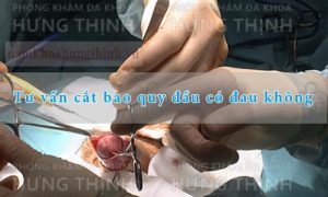 Tư vấn cắt bao quy đầu