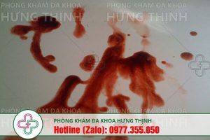 xuất tinh ra máu là bệnh gì