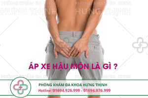 Bệnh apxe hậu môn là gì, có nguy hiểm không?