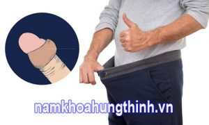 dài bao quy đầu có nên cắt không