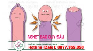 nghẹt bao quy đầu