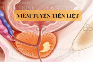 Viêm tiền liệt tuyến có nguy hiểm không?
