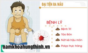 đại tiện ra máu là bệnh gì