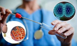 xét nghiệm bệnh lậu