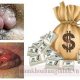 Chi phí điều trị bệnh trĩ