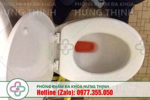 tiểu ra máu là bệnh gì