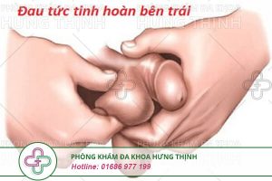 Đau tinh hoàn trái- Nguyên nhân, triệu chứng và cách điều trị