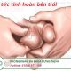 Đau tinh hoàn trái- Nguyên nhân, triệu chứng và cách điều trị
