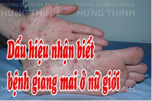 Bệnh giang mai ở nữ - Nguyên nhân, Triệu Chứng, Cách chữa