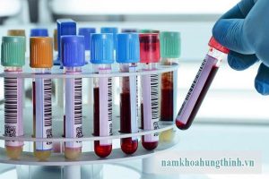 Quy trình xét nghiệm tpha