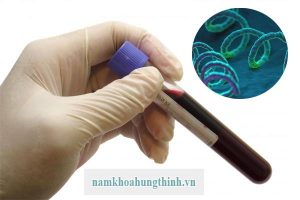 Các phương pháp xét nghiệm bệnh giang mai