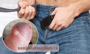 sưng, ngứa, đỏ bao quy đầu