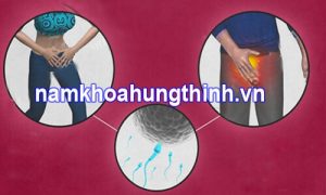 Kinh nghiệm khám vô sinh hiếm muộn cho nam và nữ