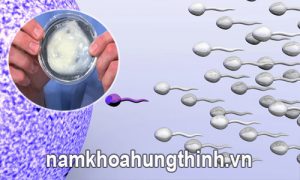 Tinh trùng vón cục gây khó có con
