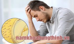 Tinh trùng vón cục màu vàng