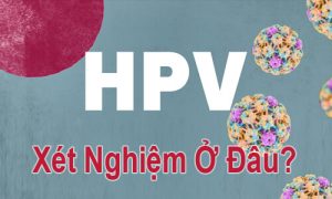 xét nghiệm hpv ở đâu