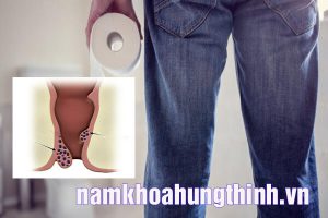 cắt trĩ bao lâu thì lành