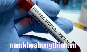 xét nghiệm hsv ở đâu