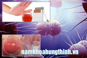 bị bệnh lậu nên kiêng ăn những gì