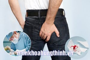 Bị chảy máu sau khi cắt búi trĩ có sao không