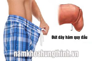 Dây hãm quy đầu bị đứt