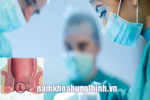Phác đồ điều trị nứt kẽ hậu môn